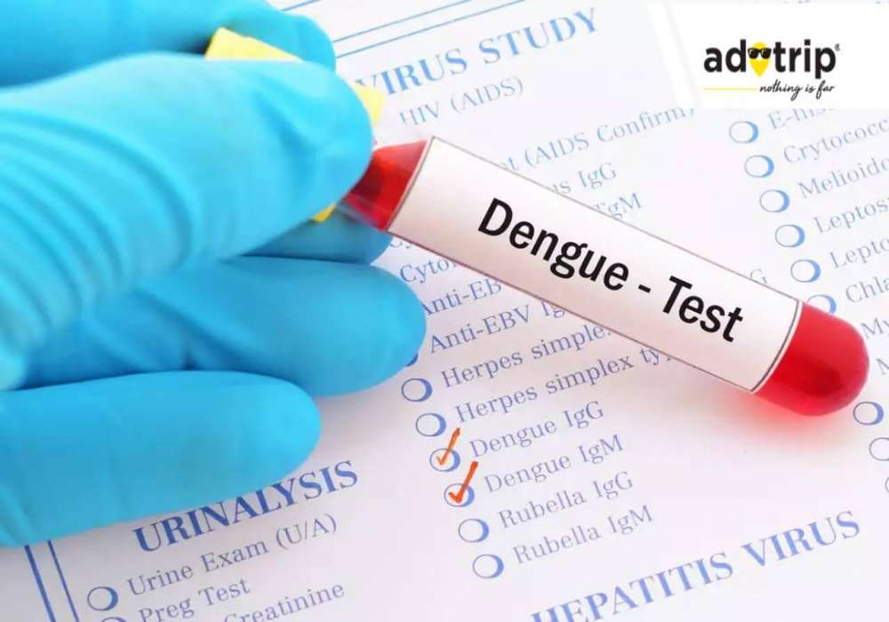 dengue test cost in india, dengue test price in india